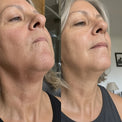 Deborah W., 63&nbsp;